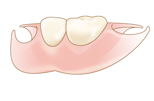 入れ歯