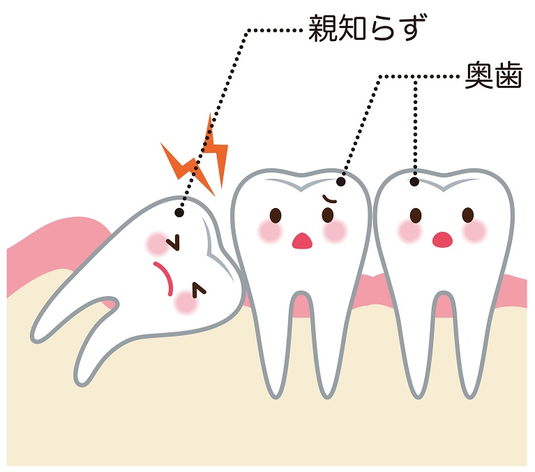 親知らず抜歯なら神戸市西区の やましたデンタルクリニック へ