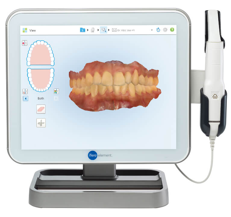 3D光学スキャナー「iTero Element」の導入により、印象材を使った型取りが不要に